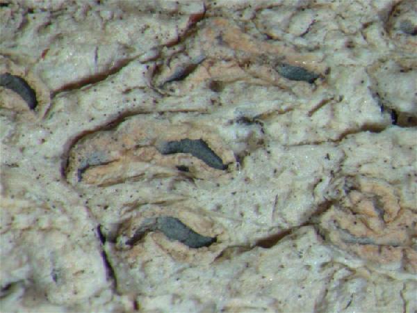 Acanthothecis aurantiaca (Müll. Arg.) Staiger & Kalb