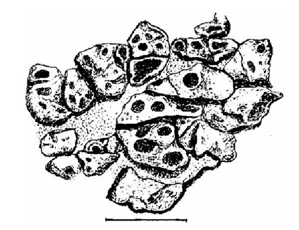 Acarospora cartilaginea H. Magn.