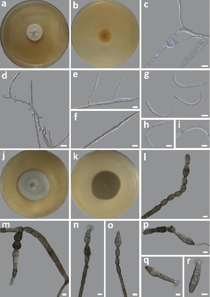 Amphisphaeria falcata H.L. Si, R.L. Chang, T. Bose & Yi C. Wang
