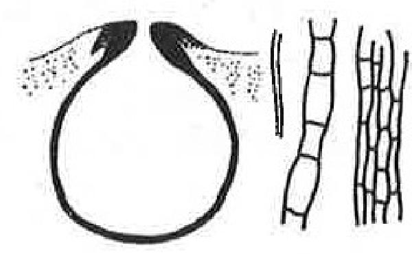 Amphoridium koerberi Hepp ex Arnold