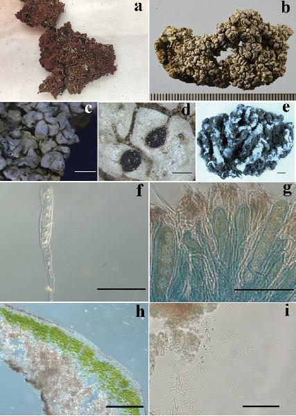 Anamylopsora pruinosa D.L. Liu & X.L. Wei