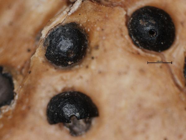 Anthracothecium variolosum (Pers.) Müll. Arg.