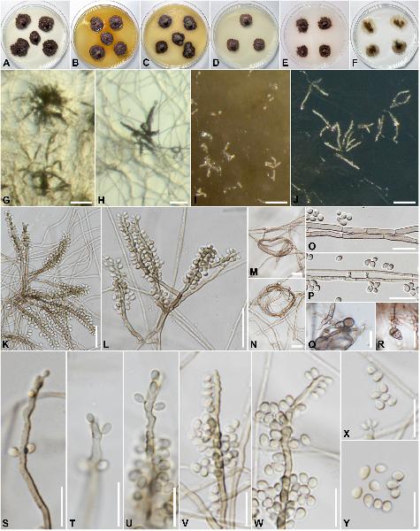 Atrokylindriopsis racemosospora Senwanna, Kumla & Suwannar.
