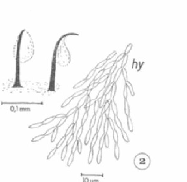 Aulaxina dictyospora R. Sant.
