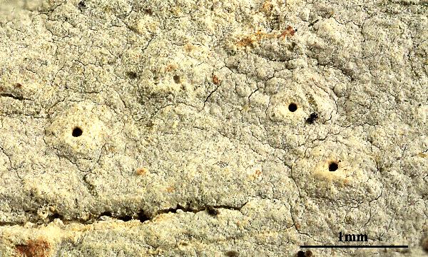 Ocellularia albula (Nyl.) Zahlbr.