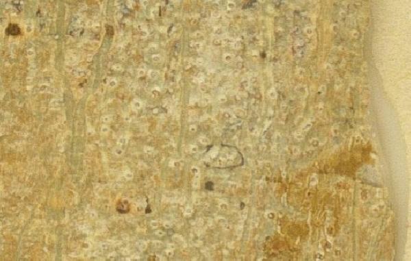 Ocellularia laeviusculoides Sipman & Lücking