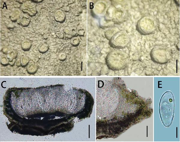 Ochrolechia guizhouensis Zheng & Meng