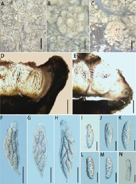 Ochrolechia kuankuoshuiensis Zheng & Meng