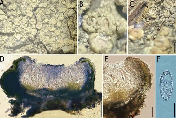 Ochrolechia leigongshanensis Zheng & Fu