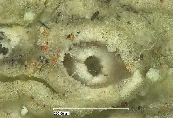 Austrotrema bicinctulum (Nyl.) I.D. Medeiros, Lücking & Lumbsch